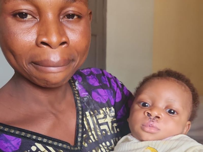 Mother and child after surgery